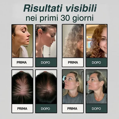 HYDROLUXE™ – Elimina cloro e cal dalla tua doccia.